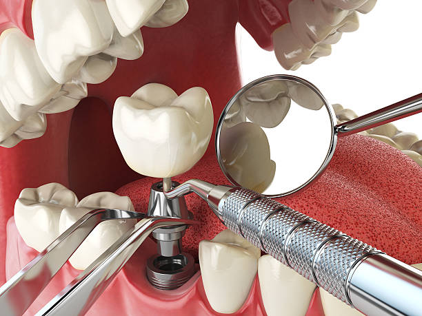 Best Emergency Treatment for Jaw Pain or Injury in Reserve, LA